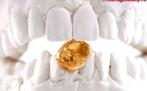 Использование золота в стоматологии: цена за грамм и проба зубной коронки